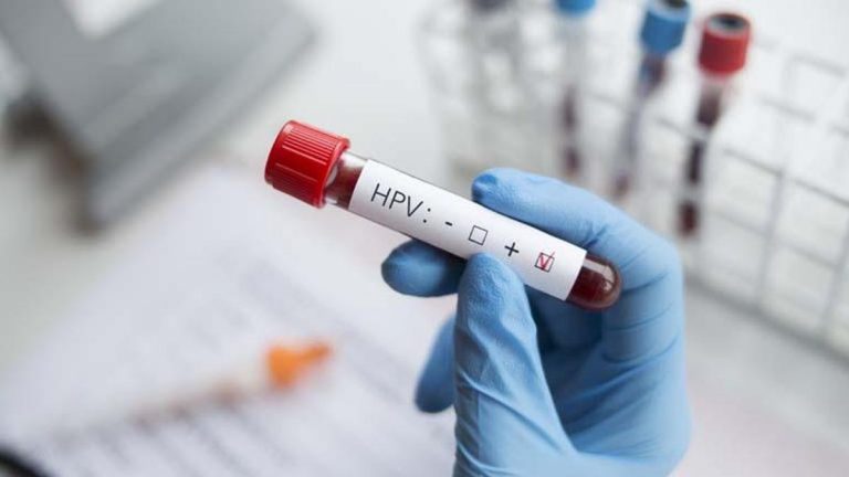 “HPV’nin kansere neden olan türleri var, etmeyen türleri de var”