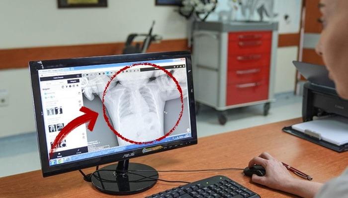 Ankara'da şok olay!  10 aylık bebek bir anda kusmaya başladı, ortaya çıkan gerçek yürekleri ağza getirdi