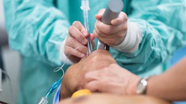 Entübasyon ne anlama geliyor? Entübasyon nedir? Entübe hasta nedir? Entübe hastanın görüntüsü