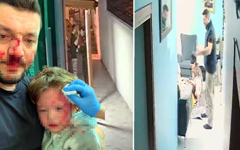 Yalova'da Aile İçi Şiddet Davası: Baba ve 14 Aylık Kızına Saldıran Kişi Tutuklandı, Son Durum Güncellendi